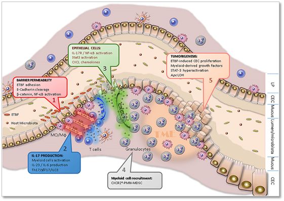 腸道細菌大腸桿菌與脆弱類桿菌聯(lián)合，或能導致結(jié)直腸癌癥發(fā)生