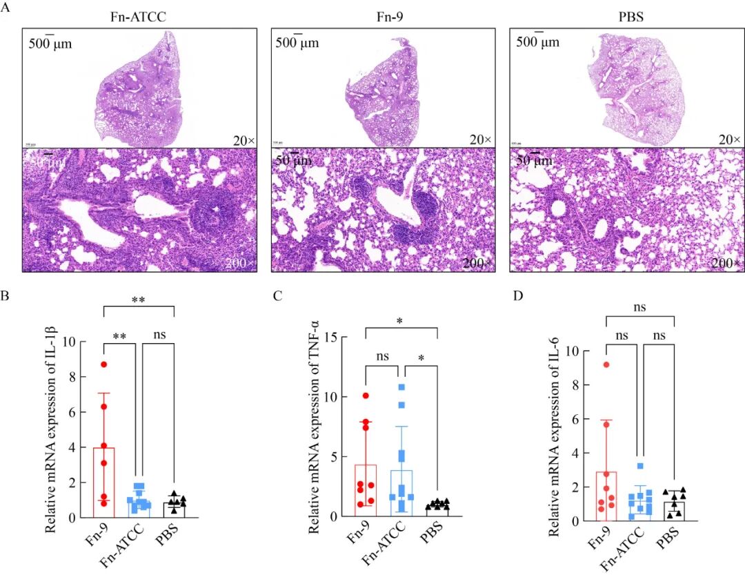 基于細(xì)菌生長曲線測定探究具核梭桿菌促進(jìn)肺癌發(fā)展的潛在機(jī)制（一）
