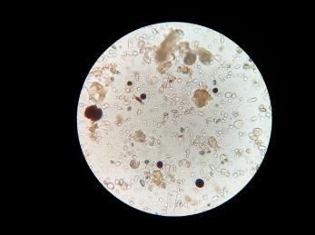快速藥敏檢測(cè)技術(shù)方法、原理、臨床轉(zhuǎn)化需求（一）