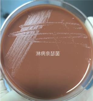 不同保存條件、培養(yǎng)基對淋病奈瑟菌存活率的影響——結(jié)果、討論