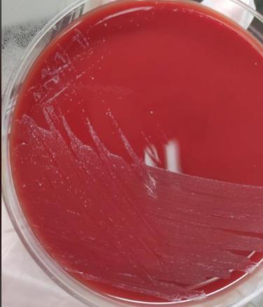 不同保存條件、培養(yǎng)基對淋病奈瑟菌存活率的影響——摘要、材料與方法